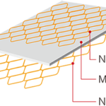 UVENTA™ Ureteral Stent