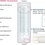 UVENTA™ Urethral Stent